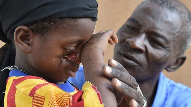 bai-viet/cam-tau-ma-la-gi-nguyen-nhan-va-trieu-chung-cua-benh-59307.html