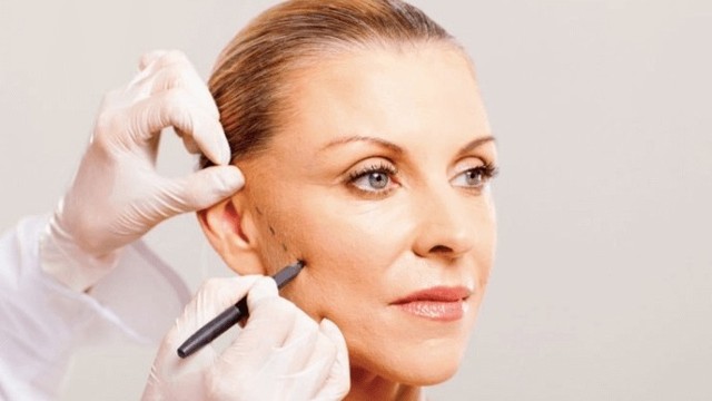 bai-viet/cang-da-mat-noi-soi-co-thuc-su-hieu-qua-khong.html