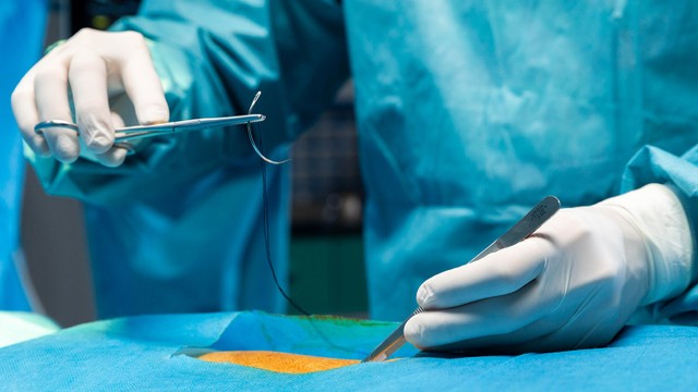 bai-viet/cat-chi-con-sot-co-sao-khong-cac-loai-chi-khau-trong-phau-thuat.html