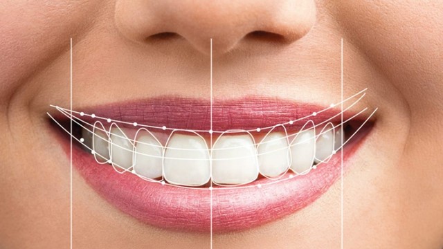 bai-viet/cat-loi-tham-my-la-gi-co-nguy-hiem-khong-63471.html