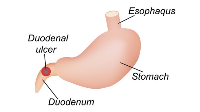 bai-viet/hanh-ta-trang-co-cau-tao-the-nao-cac-benh-ly-lien-quan-den-hanh-ta-trang.html