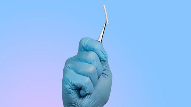 bai-viet/co-nen-cay-que-tranh-thai-sau-sinh-mo-khong-dau-la-thoi-diem-thich-hop.html