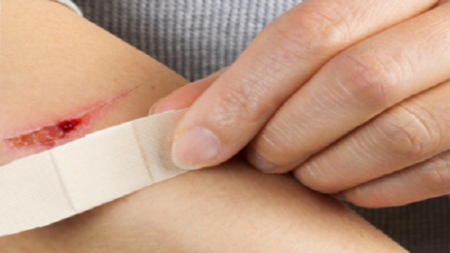 bai-viet/cham-lanh-vet-thuong-o-benh-nhan-dieu-tri-ung-thu-54299.html