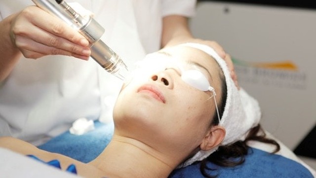 bai-viet/cham-soc-da-sau-khi-tay-not-ruoi-bang-laser-co-2.html