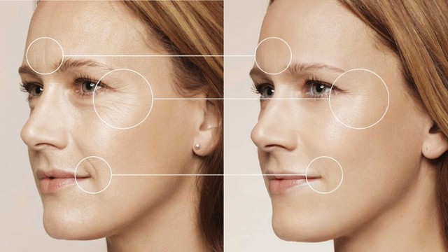 bai-viet/luu-y-cham-soc-sau-khi-cang-da-mat-bang-chi-67371.html