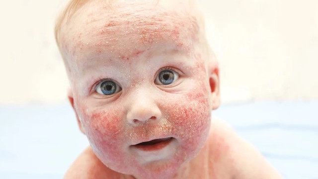 bai-viet/cham-sua-co-tu-het-khong-lam-the-nao-de-cham-sua-nhanh-khoi.html