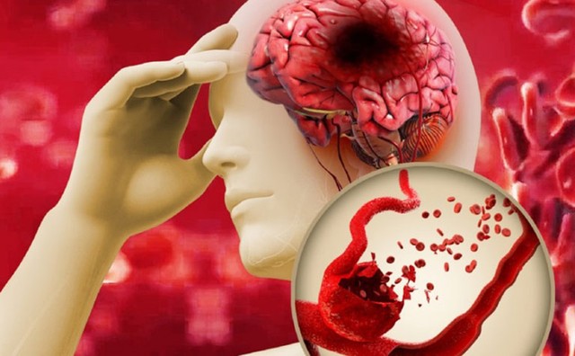 bai-viet/phuong-phap-chan-doan-va-dieu-tri-xo-vua-dong-mach-nao.html