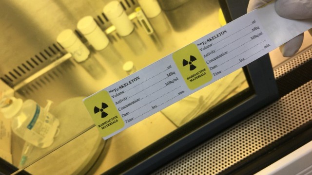 bai-viet/chat-phong-xa-gay-ung-thu-khi-nao-phuong-phap-dieu-tri-ung-thu-bang-duoc-chat-phong-xa.html