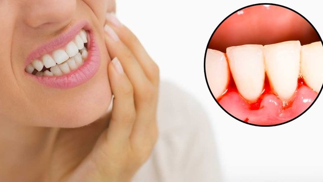 bai-viet/chay-mau-chan-rang-bat-thuong-nguyen-nhan-va-cach-dieu-tri-57625.html