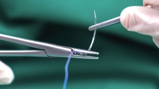 bai-viet/chi-tu-tieu-bi-roi-ra-co-sao-khong.html