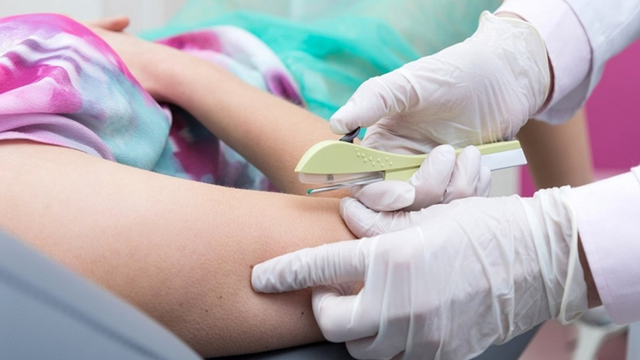 bai-viet/chi-phi-cay-que-tranh-thai-la-bao-nhieu-yeu-to-anh-huong-den-chi-phi-cay-que.html