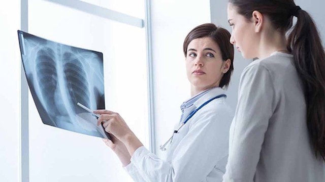 bai-viet/chi-phi-hoa-tri-ung-thu-phoi-co-ton-kem-khong-52046.html