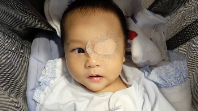 bai-viet/chi-phi-phau-thuat-chinh-mat-le-va-nhung-dieu-can-biet-truoc-khi-thuc-hien.html