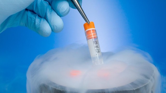 bai-viet/chi-phi-tru-dong-trung-la-bao-nhieu.html