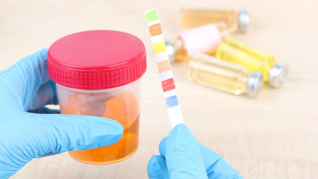 bai-viet/chi-so-albumin-trong-nuoc-tieu-cao-dau-hieu-canh-bao-som-cac-benh-ly-nguy-hiem.html