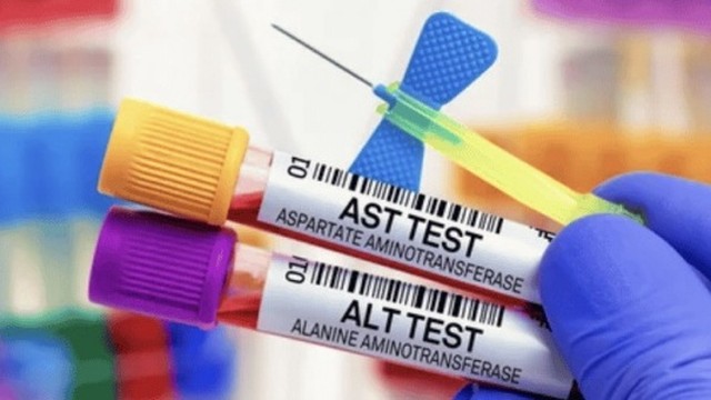 bai-viet/chi-so-ast-va-alt-la-gi-phan-anh-nhu-the-nao-ve-tinh-trang-suc-khoe-cua-ban.html