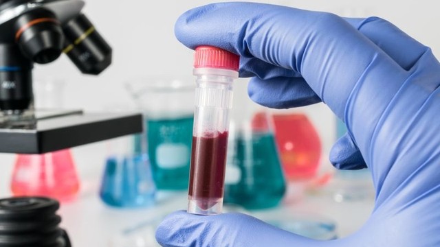 bai-viet/chi-so-crp-o-tre-em-cao-co-sao-khong-y-nghia-cua-chi-so-crp.html