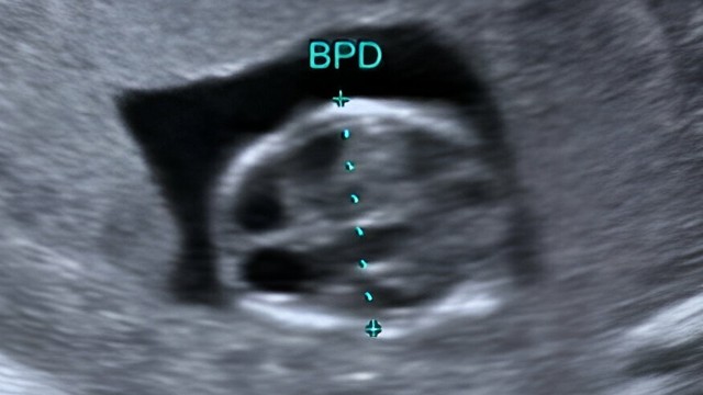 bai-viet/chi-so-duong-kinh-luong-dinh-thai-36-tuan-nhu-the-nao-la-binh-thuong.html