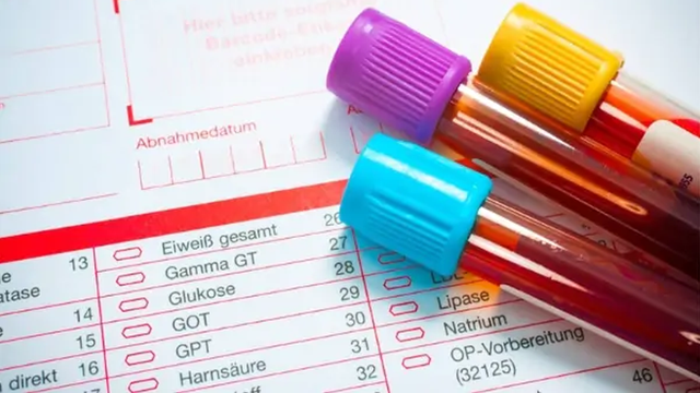 bai-viet/chi-so-gpt-la-gi-khi-nao-can-thuc-hien-xet-nghiem-alt-gpt-65320.html