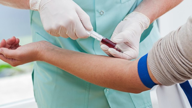 bai-viet/chi-so-mcv-la-gi-co-y-nghia-nhu-the-nao-68882.html