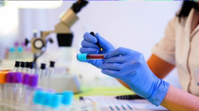 bai-viet/chi-so-pdw-la-gi-nhung-dieu-can-biet-ve-chi-so-pdw-70385.html