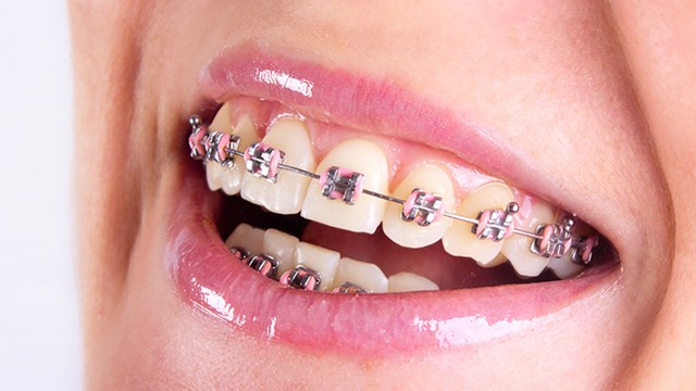 bai-viet/chinh-nha-la-gi-cac-phuong-phap-chinh-nha-thuong-gap.html