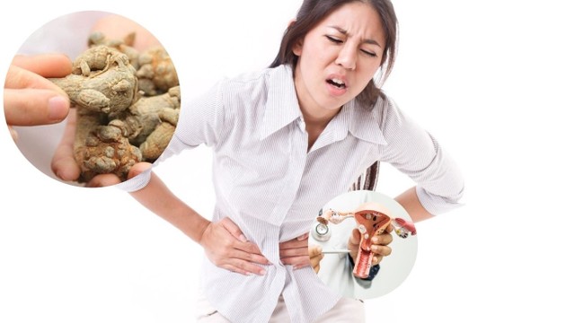 bai-viet/chua-u-xo-tu-cung-bang-tam-that-co-hieu-qua-khong.html