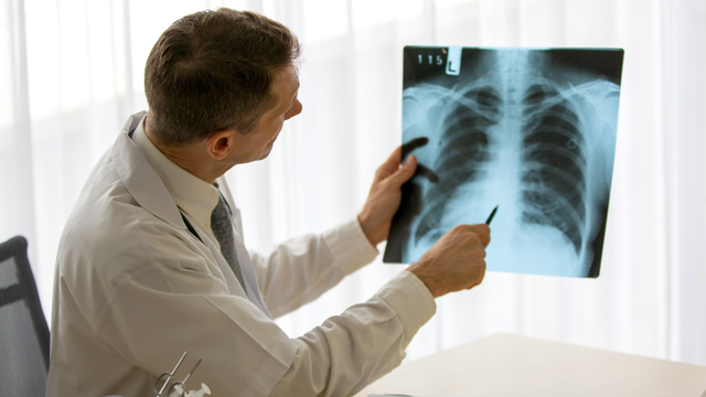 bai-viet/chup-x-quang-xo-phoi-giai-phap-chan-doan-som-nhung-dau-hieu-bat-thuong-ve-benh.html