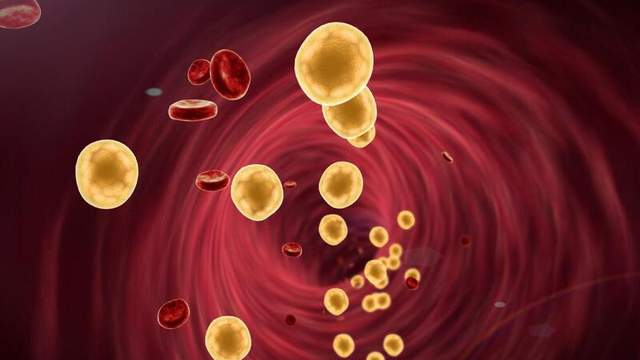 bai-viet/roi-loan-chuyen-hoa-lipid-trong-mau-la-nhu-the-nao-nguyen-nhan-va-dieu-tri.html