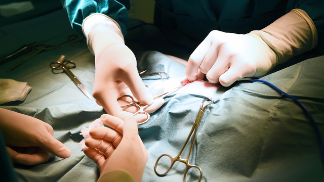 bai-viet/co-nen-cat-amidan-cho-nguoi-lon-khong-nguy-co-va-loi-ich.html