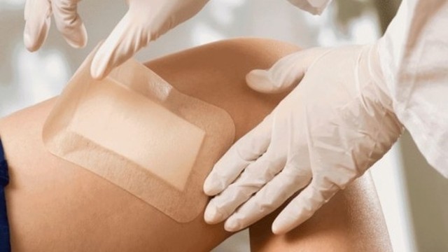 bai-viet/co-nen-dan-cao-hut-mu-vao-vet-thuong-khong.html