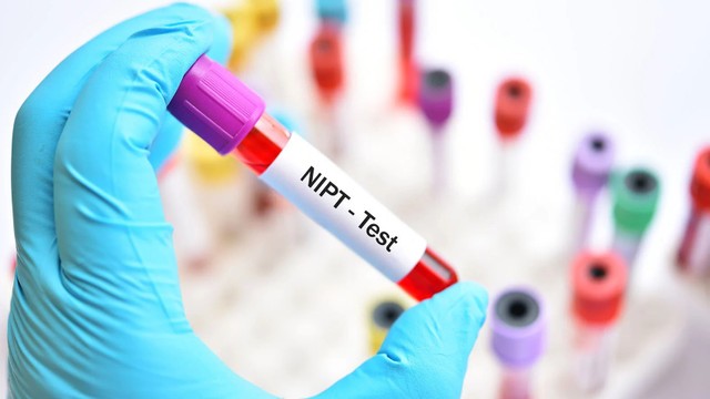 bai-viet/lieu-co-xet-nghiem-nipt-24-cap-nhiem-sac-the-khong-cach-chon-goi-xet-nghiem.html