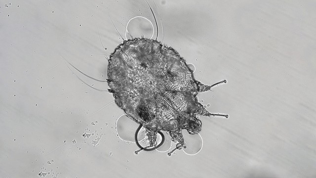 bai-viet/con-cai-ghe-la-gi-co-nguy-hai-den-suc-khoe-khong.html