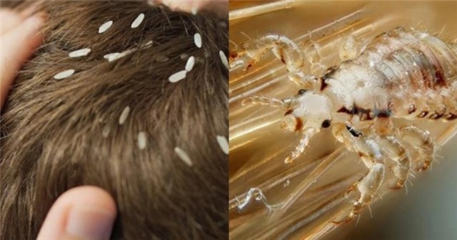 bai-viet/con-chay-sinh-ra-tu-dau-nguyen-nhan-va-cach-phong-ngua-46802.html