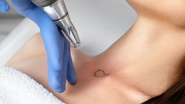 bai-viet/cong-nghe-laser-q-switched-va-tat-tan-tat-nhung-dieu-can-biet.html