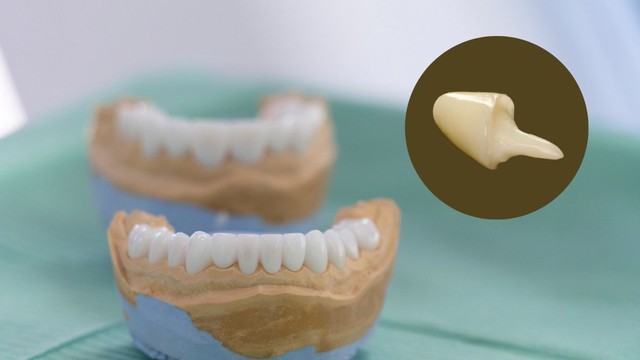 bai-viet/cui-gia-zirconia-la-gi-uu-nhuoc-diem-va-gia-tien.html