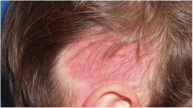 bai-viet/da-dau-bi-do-nguyen-nhan-do-dau.html