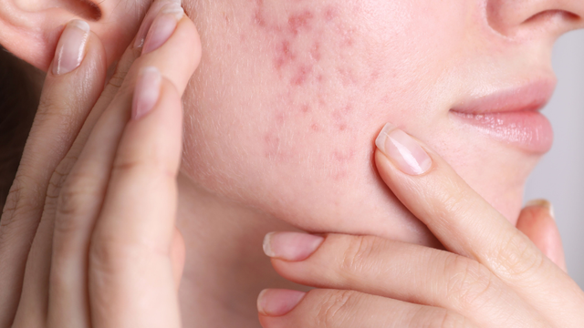 bai-viet/da-dau-can-bo-sung-vitamin-gi-de-cai-thien-luong-ba-nhon-hieu-qua.html