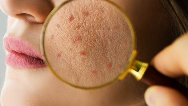 bai-viet/da-dau-can-bo-sung-vitamin-gi-goi-y-mot-so-duong-chat-danh-cho-da.html