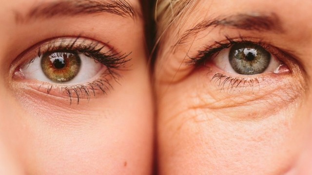 bai-viet/da-mat-nhan-nheo-do-dau-cach-cai-thien-tinh-trang-da-mat-nhan-nheo-50824.html