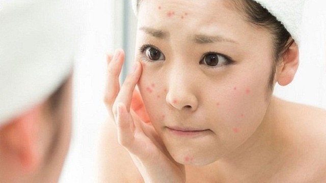 bai-viet/da-mun-co-nen-dap-sua-chua-khong-duong.html