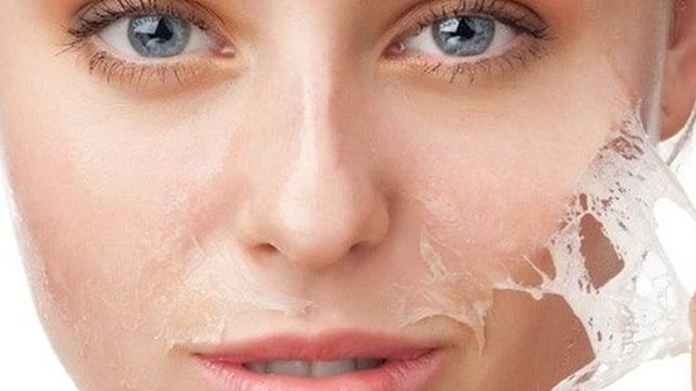 bai-viet/da-nhay-cam-co-nen-peel-da-khong-bi-quyet-cham-soc-cho-lan-da-nhay-cam.html