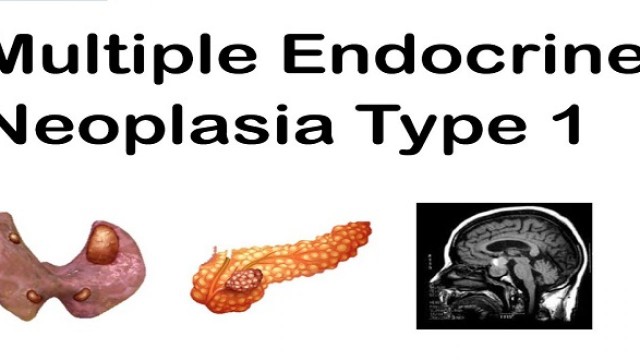 bai-viet/da-u-tuyen-noi-tiet-typ-1-men1-55545.html