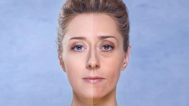 bai-viet/da-xin-mau-sam-den-la-do-dau-cach-khac-phuc-da-xin-mau-hieu-qua.html