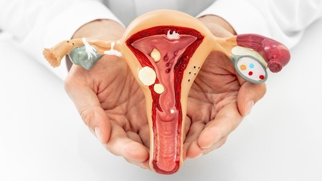 bai-viet/dac-diem-hinh-anh-polyp-co-tu-cung.html