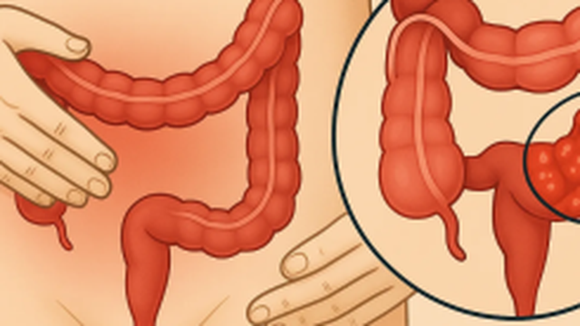 bai-viet/dai-trang-chau-hong-la-gi-cac-benh-ly-lien-quan-den-dai-trang-chau-hong.html