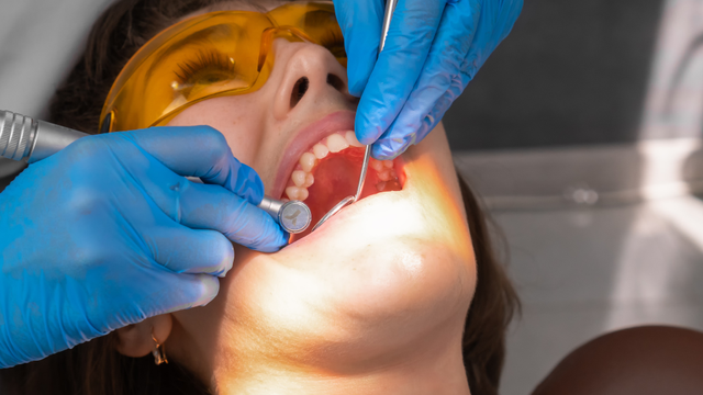 bai-viet/dap-rang-khenh-giu-duoc-bao-lau-uu-nhuoc-diem-cac-phuong-phap.html