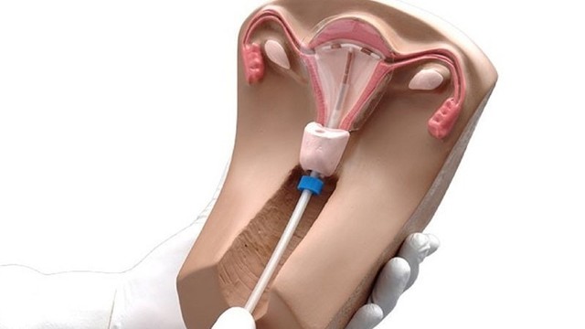 bai-viet/dat-vong-tranh-thai-co-dung-duoc-coc-nguyet-san-khong-62943.html