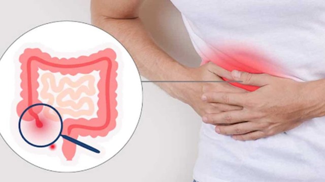 bai-viet/bi-dau-bung-buon-non-di-ngoai-la-canh-bao-van-de-suc-khoe-nao.html