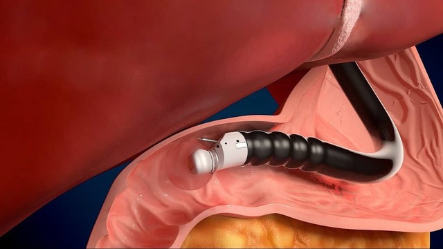 bai-viet/dau-da-day-nen-sieu-am-hay-noi-soi-cho-ket-qua-tot-nhat.html